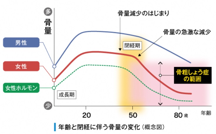 骨量変化のグラフ